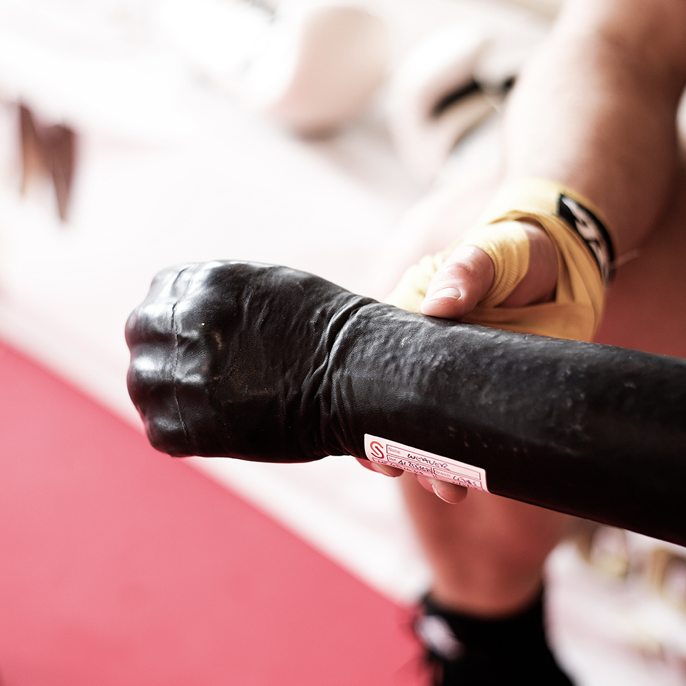 James' Boxing Story: Bespoke Upper Limb Prosthesis