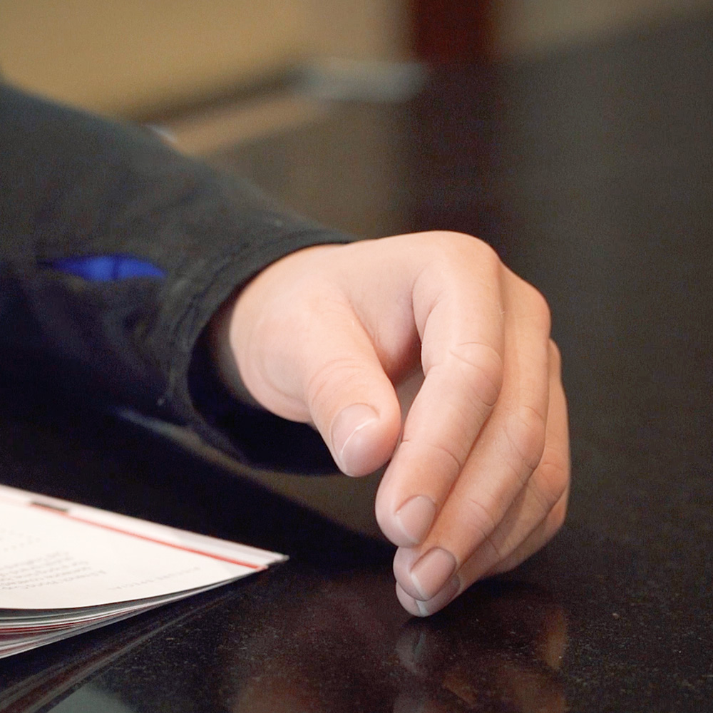 Toby's Story: Embracing Reality with High-Definition Custom Silicone Prosthetics