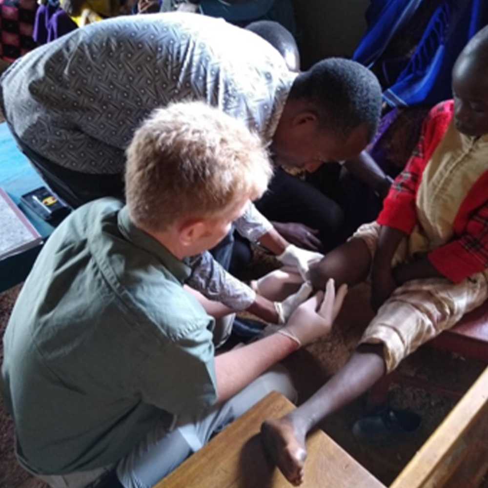 Steeper Prosthetist Assists Opening of Prosthetic Service at Kagando Hospital in Uganda