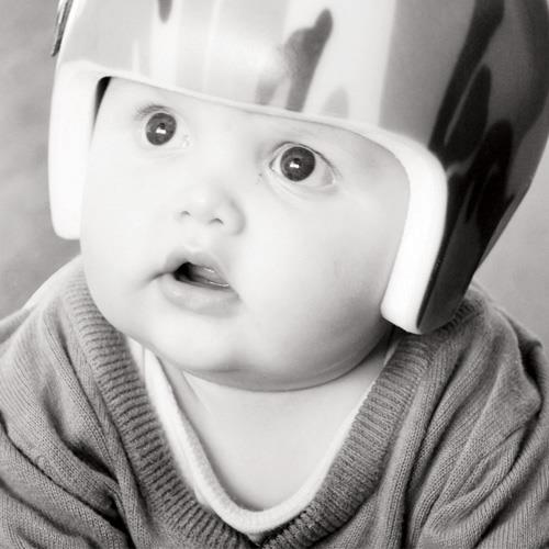 Tommy-Ray helps raise the profile of Plagiocephaly