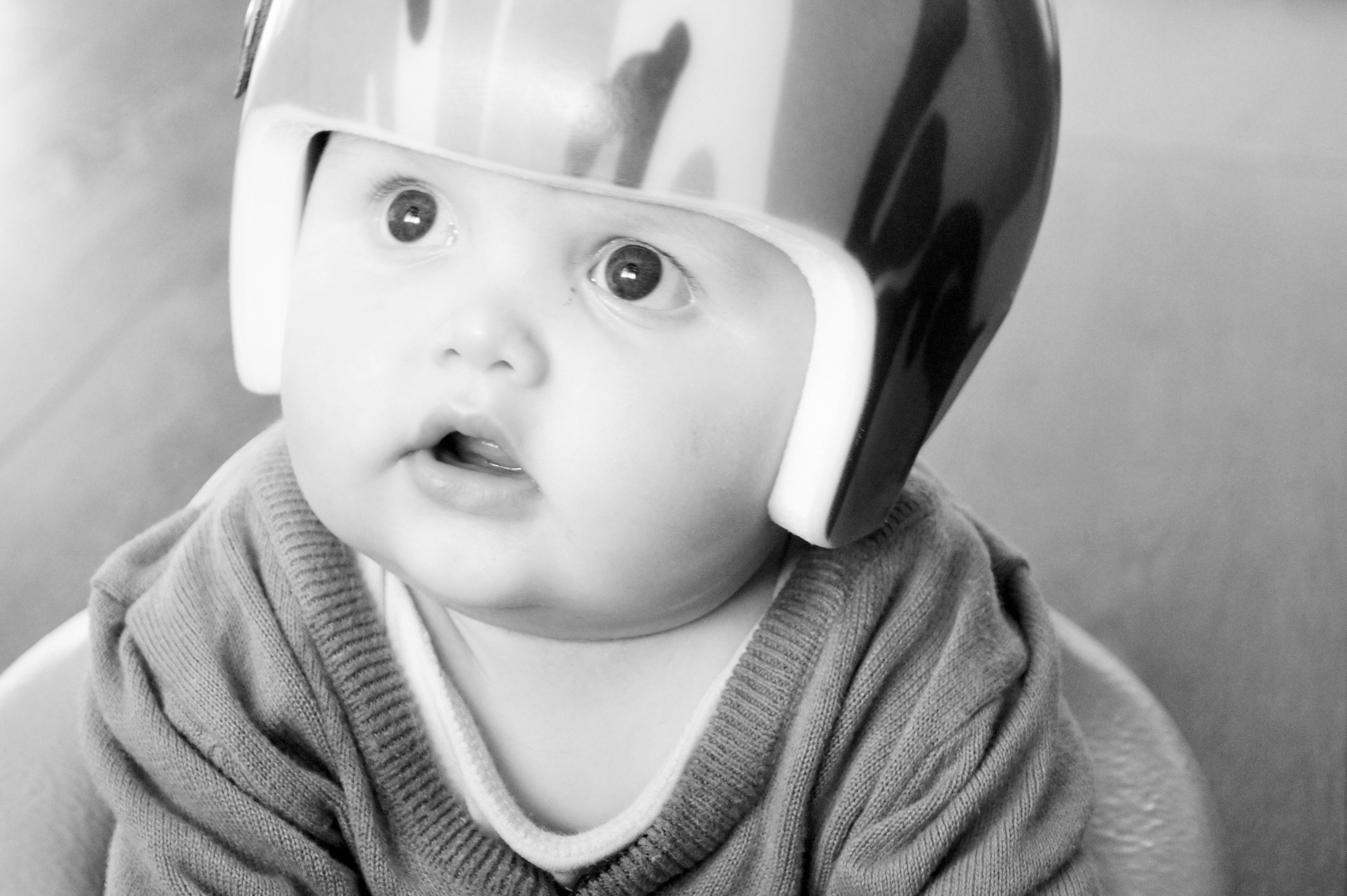 Tommy-Ray helps raise the profile of Plagiocephaly