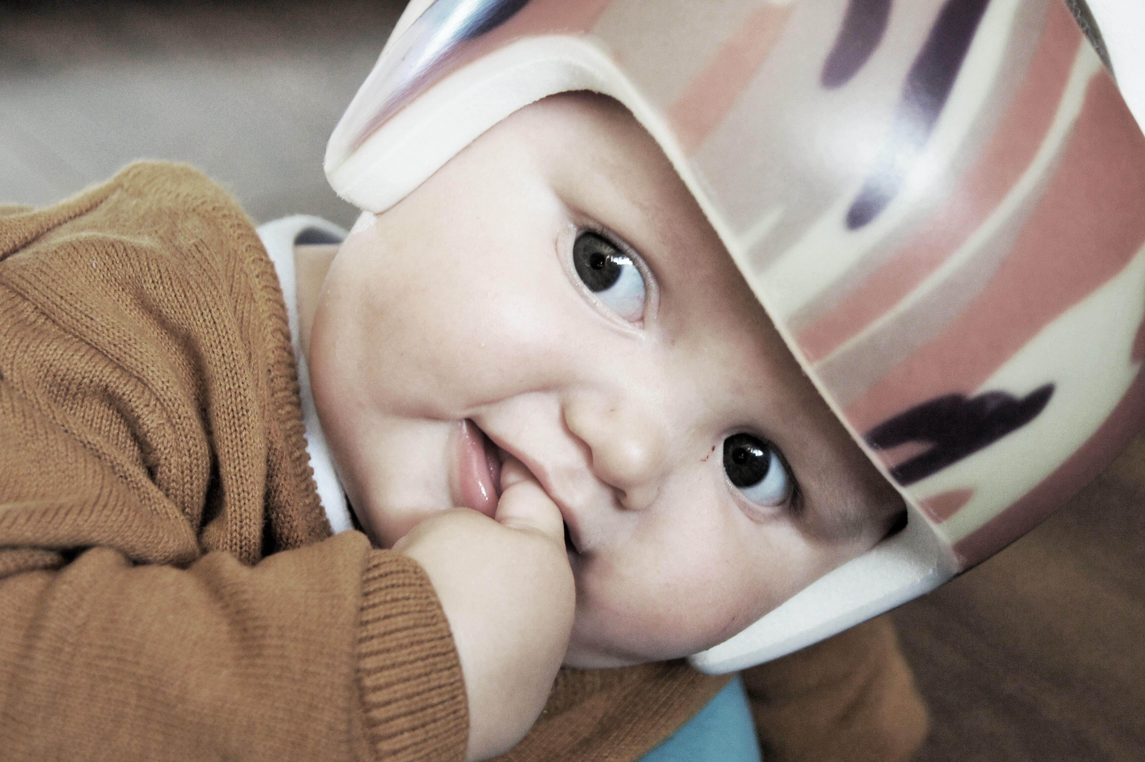 Tommy-Ray helps raise the profile of Plagiocephaly