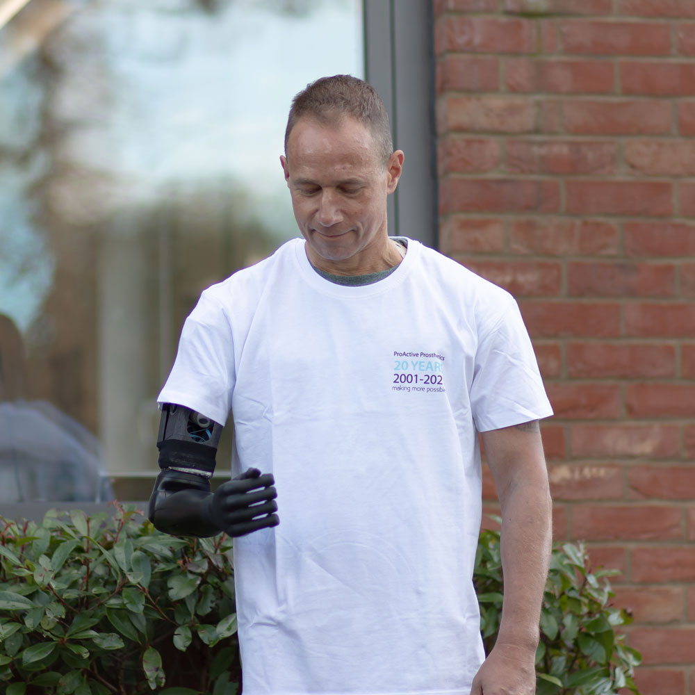 Prosthetic industry unites to support ‘One of Their Own’ and complete the treatment circle.